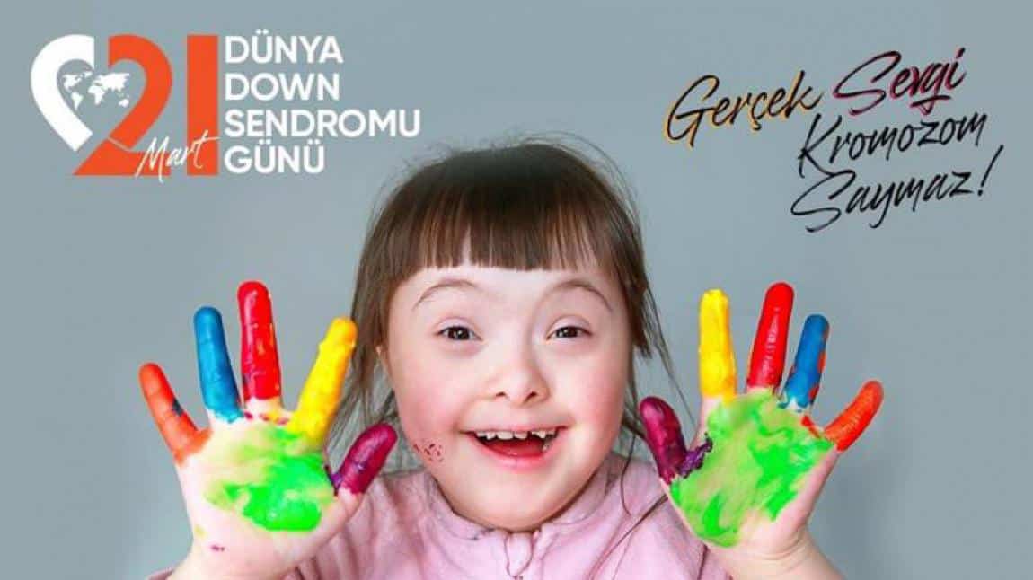 21 Mart Dünya Down Sendromu Günü Kutlu Olsun...